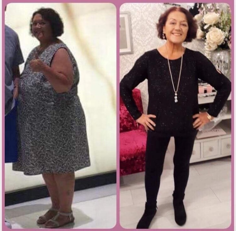 Other image for Why slimmers are Barnsley’s biggest losers...